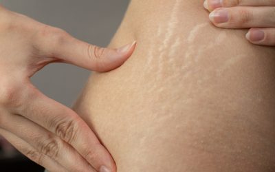 Comment rapporter des soins pour le corps après l’accouchement ?