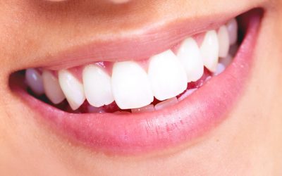 Comment blanchir ses dents rapidement ?